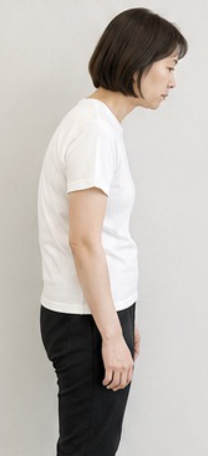 施術前の横向き姿勢(40代女性)