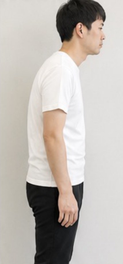 施術前の横向き姿勢(30代男性)
