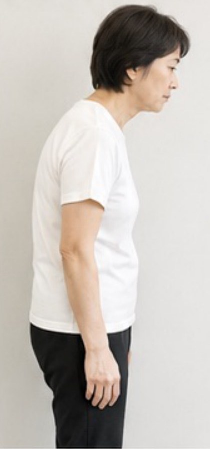 施術前の横向き姿勢(50代女性)