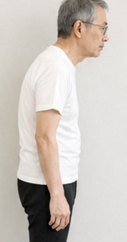 施術前の横向き姿勢(60代男性)